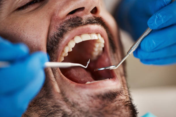 Best Emergency Treatment for Dental Infections or Abscesses in Monticello, WI